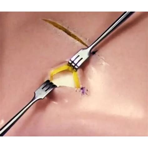 Buy GDC Senn - Miller Blunt Tissue Retractor 16cm (Trsm2) – Oralkart