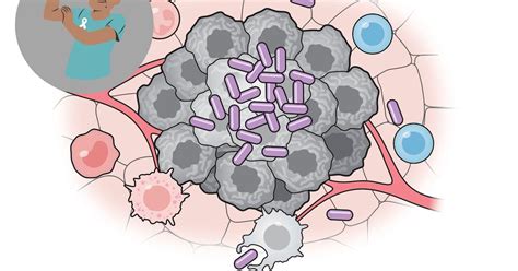 Desarrollan vacuna bacteriana que puede suprimir el cáncer en ratones y ...