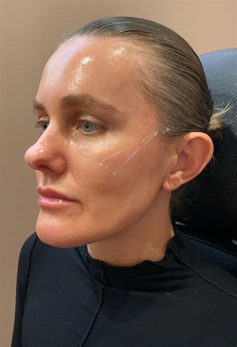 New Thread Lift 的图像结果