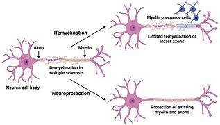 Image result for Neuroprotective
