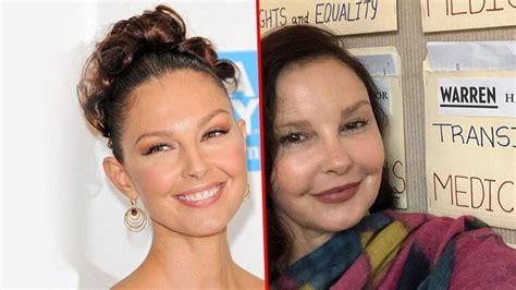 Ashley Judd was attacked for Botox, and the truth behind the aesthetic ...