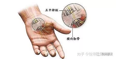 指尖麻木是什么征兆