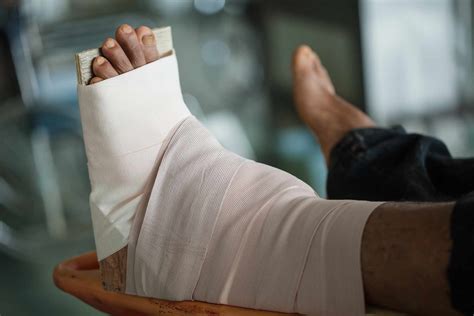 The Pros and Cons of Ankle Fusion Surgery