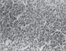 Prenatal Topiramate Exposure Induced Developmental Changes in Rat Brain ...