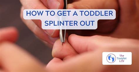 Image result for Getting Splinter Out
