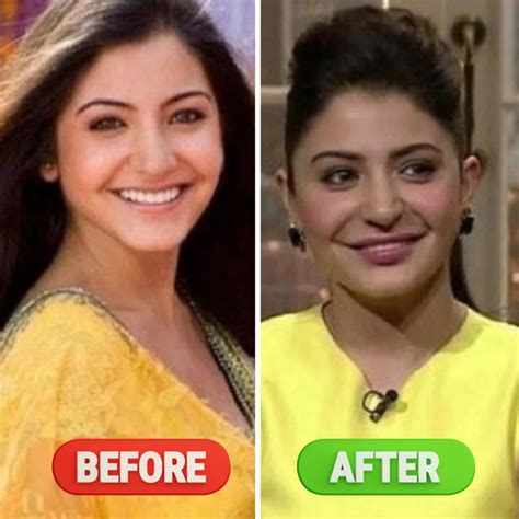 Plastic Surgery Gone Wrong | Expert Advice & Tips | GLOJAS Specialist ...