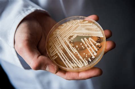 CDC警告! 致命超级真菌在纽约州爆发! 近半病患90天內死亡_传播_图片_版权