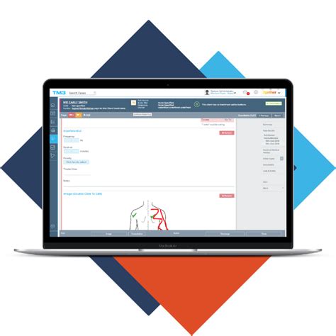 Image result for TM3 Tutorials