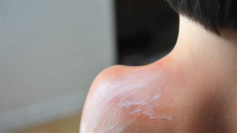 How To Stay Cool While Tanning at Guillermo Odea blog