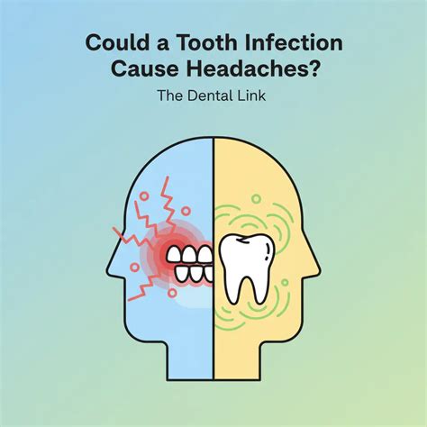Tooth Infection Headache: The Dental Pain Link – Relivehealth