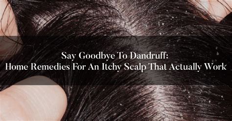 Ayurvedic Remedy for Dandruff & Itchy Scalp – OHRIA AYURVEDA