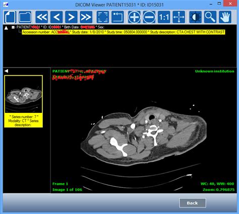 DICOM Query Retrieve Tool 的图像结果