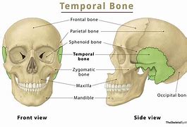 Image result for temporal bone
