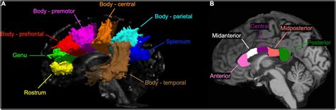 Corpus Callosum Anatomy Genu Rostrum