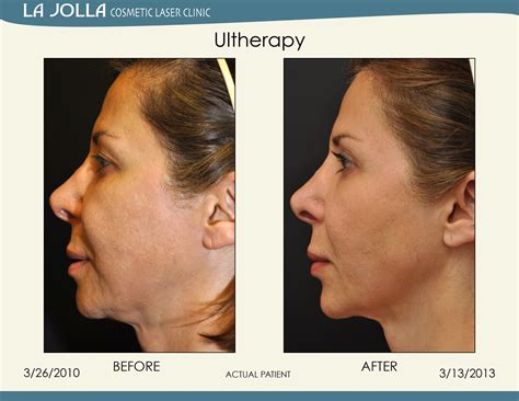 Image result for Selfie Simulator Admin Panel Script