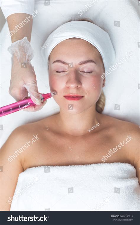 Image result for Derma Procedure