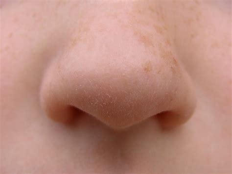鼻子周围挤出的分泌物，原来是螨虫的分泌物，2招教你清除_毛孔