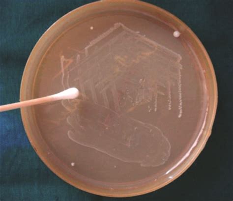 Image result for Enterococcus Faecalis MSA Plate