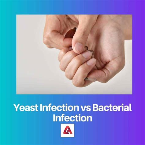 Yeast vs Bacterial Infection: Difference and Comparison