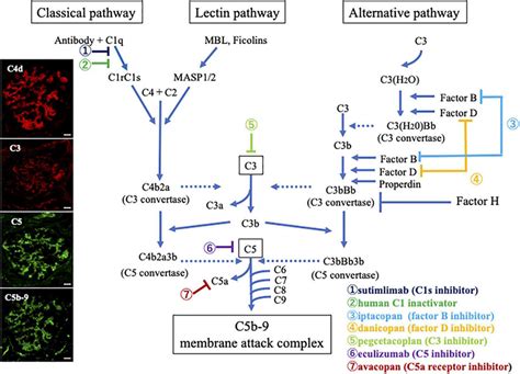 Image result for Complement Activation