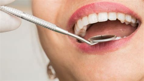 Tooth Extraction 的图像结果