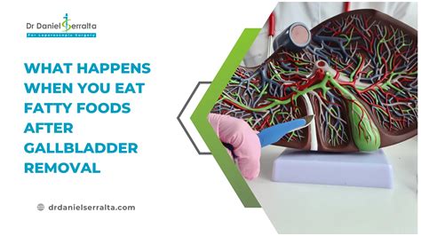 What Happens After Eating Fatty Foods Post Gallbladder Removal