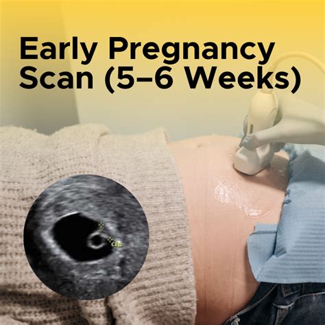 Pregnancy Ultrasound Scans at Sonobee: Monitoring Your Baby’s Growth ...