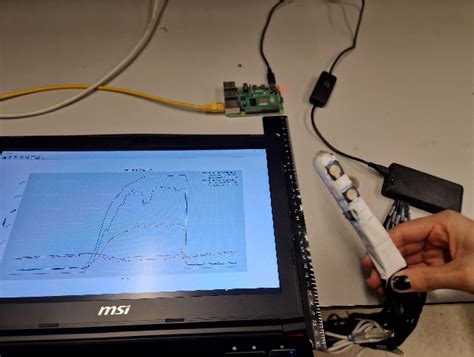 Image result for Pelvic Spring Test