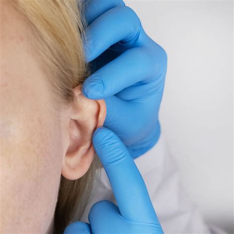 Earlobe Reconstruction - Calimed Wellness Center
