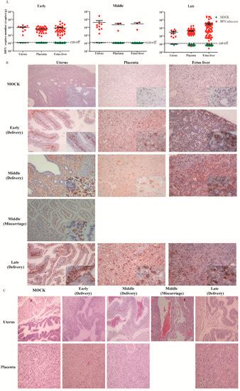 Successful Establishment of Hepatitis E Virus Infection in Pregnant ...