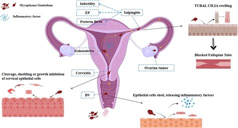 Mycoplasma Hominis And Ureaplasma Treatment Guidelines
