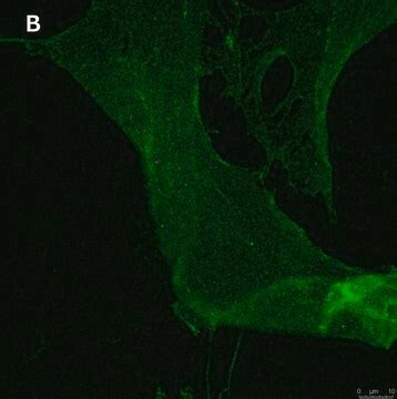 Anti-GNA-11 (G alpha 11) Antibody, clone 1F16 ZooMAb® Rabbit Monoclonal ...