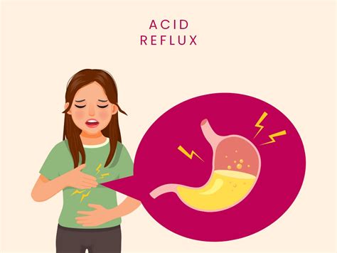 Acid Reflux Medicine 的图像结果