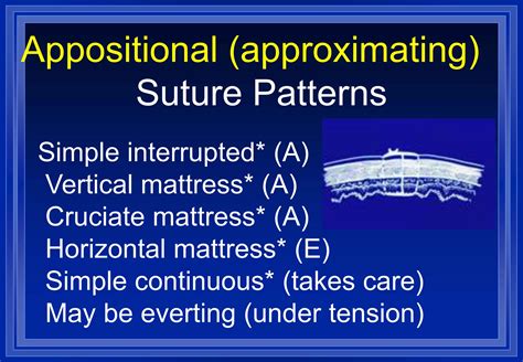Image result for Continuous Suture Patterns
