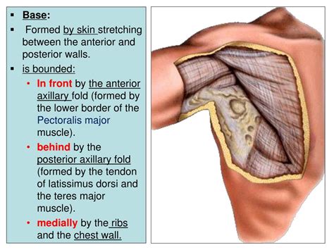 Image result for Axillary Abscess