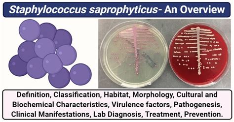 Image result for Staphylococcus Saprophyticus Infection