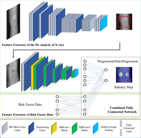 Knee Net Deep Learning Model 的图像结果