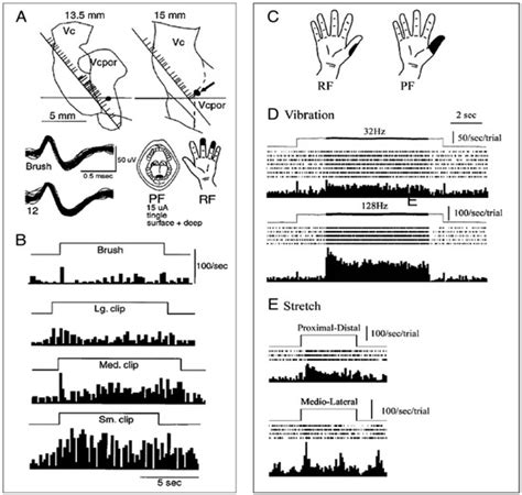 Human Thalamic Somatosensory Nucleus (Ventral Caudal, Vc) as a Locus ...