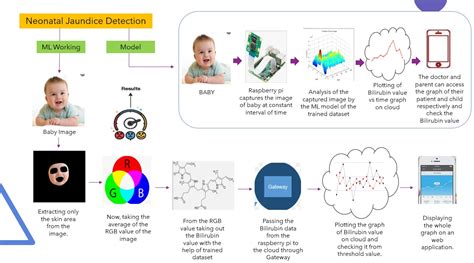 Image result for Neonatal Jaundice Algorithm