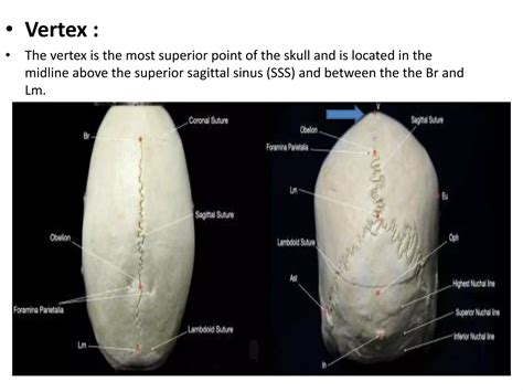 crainometric 2022.pptx