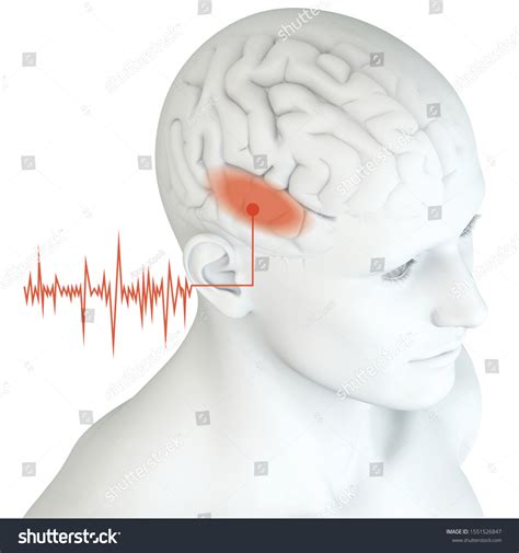 Image result for Stimulus Control Transfer ABA Example