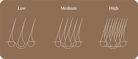 Normal Hair Density 的图像结果