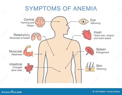 Symptoms Of Anemia. Round Banner. Iron Deficiency Royalty-Free Stock Photography | CartoonDealer ...