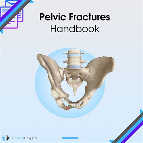 Treatment Of Open Book Pelvic Fractures – VBCTN