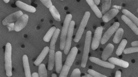 Scientists Just Discovered The Oldest Strain Of Black Death Bacteria In ...