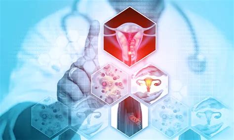 Endometrial Cancer: Symptoms, Diagnosis, Treatment, and Prevention | MOC