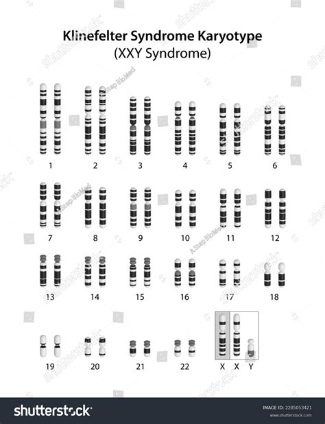 Xxy