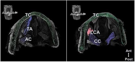 Observation of Anatomical Structures in the Human Larynx Using Micro ...