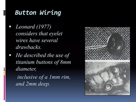 Image result for Intermaxillary Fixation
