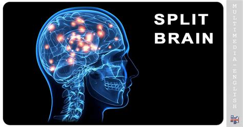 Contact Split Brain Behavioral Experiments 的图像结果